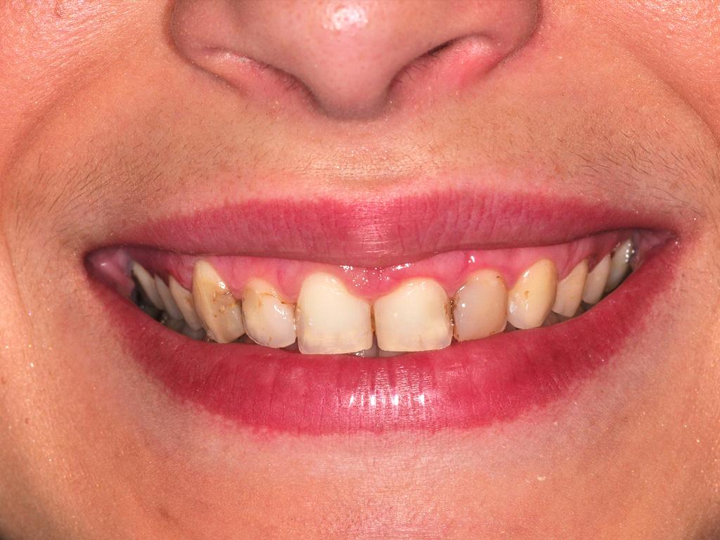 A woman smiling with a slight tooth gap