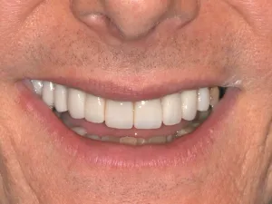 A man smiling with a bright smile