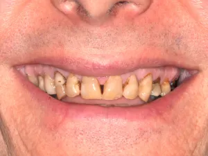 A man smiling with a smile that needs work