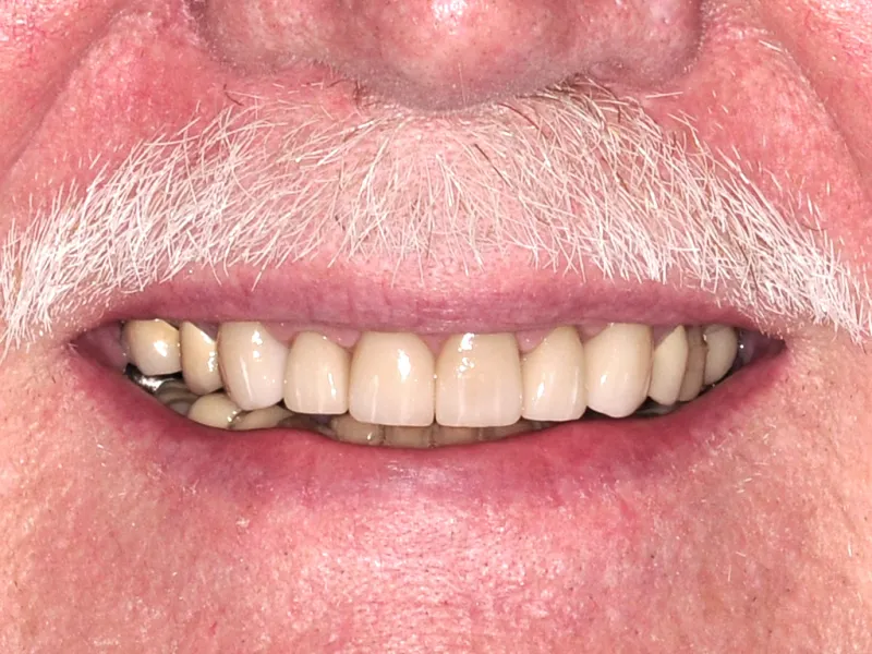 A man with a white mustache smiling with whitened teeth